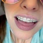 Regarde-les là-bas, c’est les Grillz Queens jouisseuses du dimanche, toujours en train de briller avec leurs dents ! 