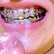 Regarde-les là-bas, c’est les Grillz Queens jouisseuses du dimanche, toujours en train de briller avec leurs dents ! 