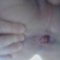 sodomis