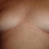 mes seins épilés